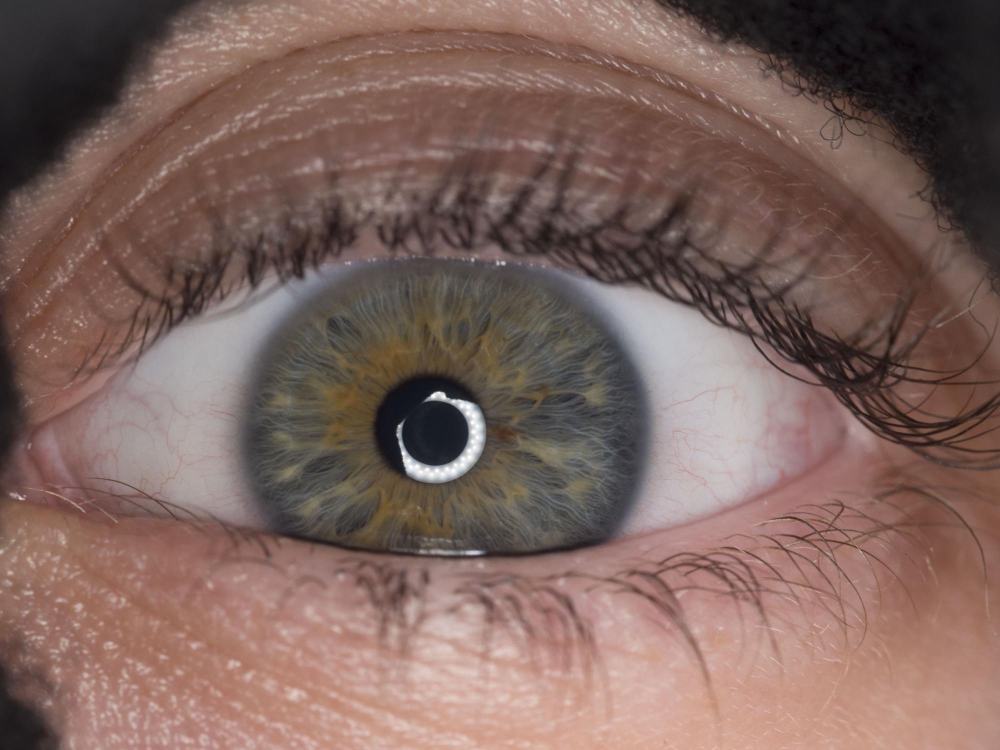 As part of the ADAPT4 study, Shriver Laboratory researchers take high-resolution photos to study the complex patterns of pigmentation of the iris.