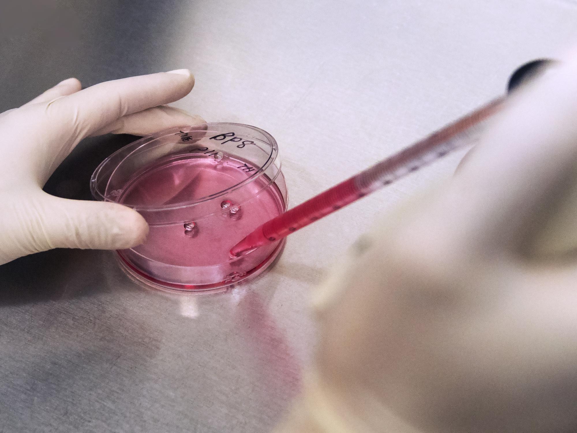 cell cultures