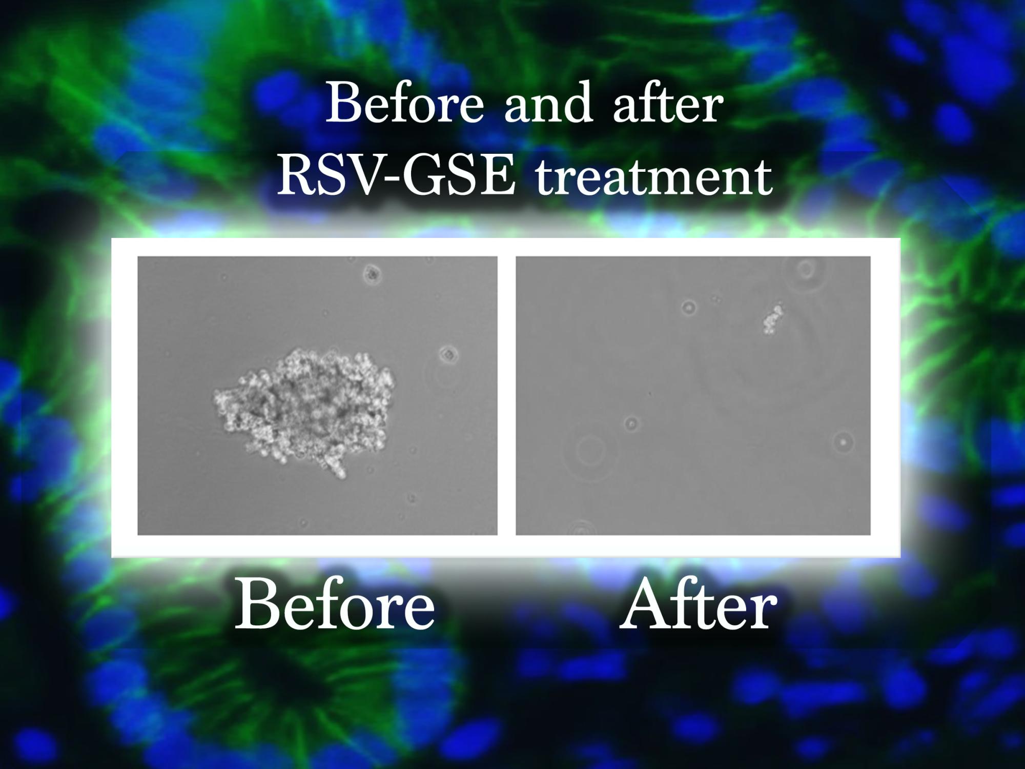 cancer stem cell