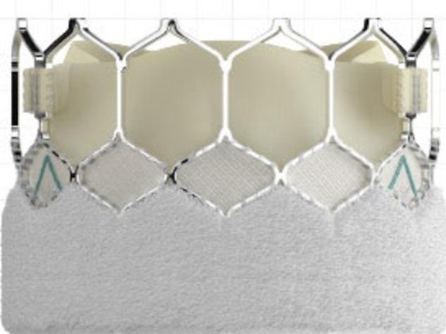 A heart valve device called the Edwards Sapien 3 Ultra Transcatheter Heart Valve System is a small circular item with a wire mesh on the top half and fabric on the bottom half.