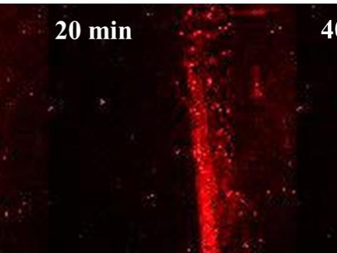 research-microscope image showing increasing bone density