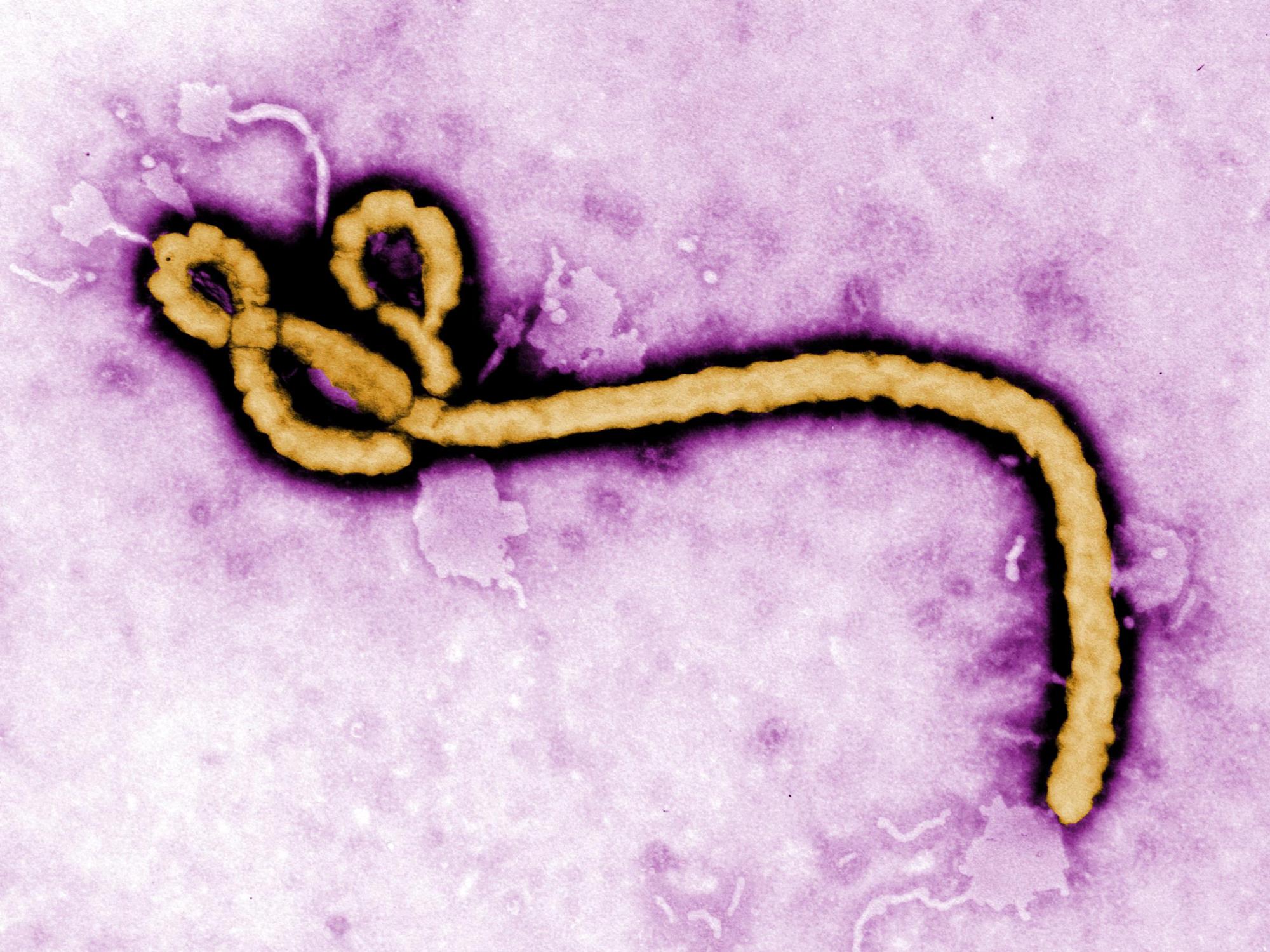 Colorized transmission electron micrograph of an Ebola virus virion.