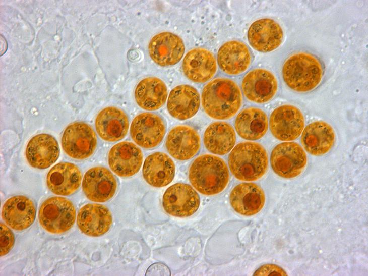 Symbiodinium cells