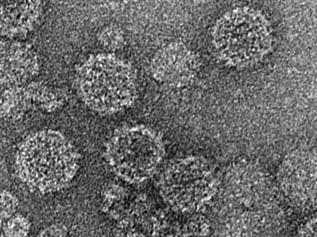 PdPV-pa virus