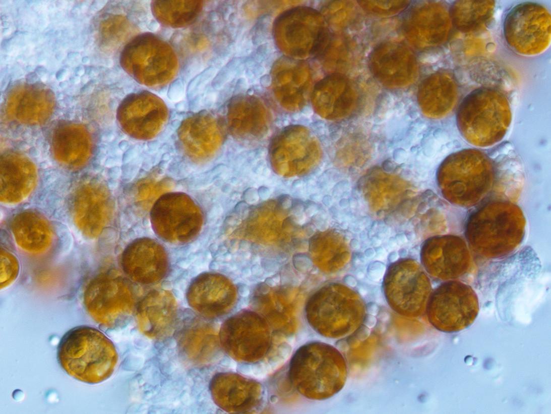 Microscope image of algae cells