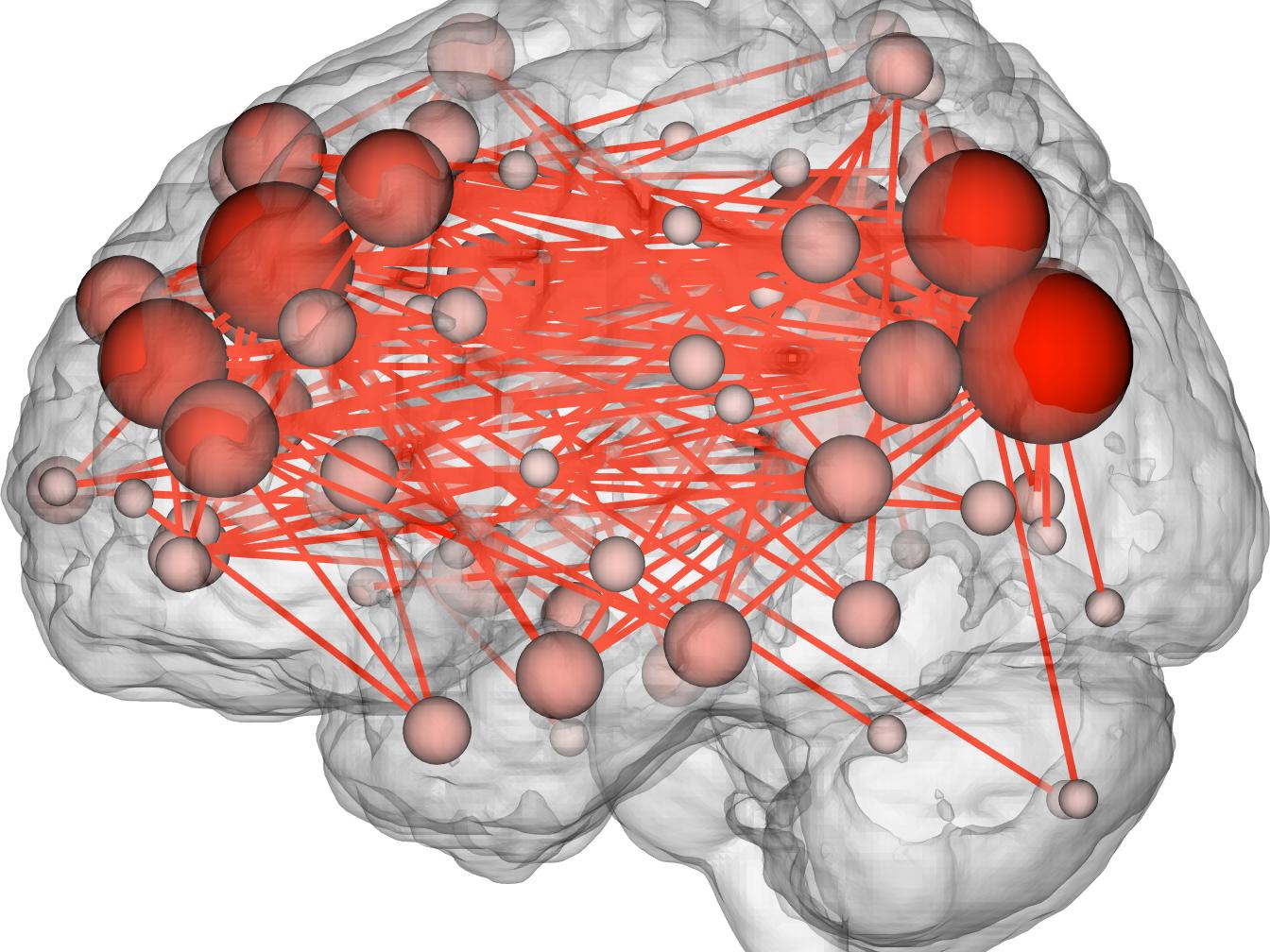brain_connect