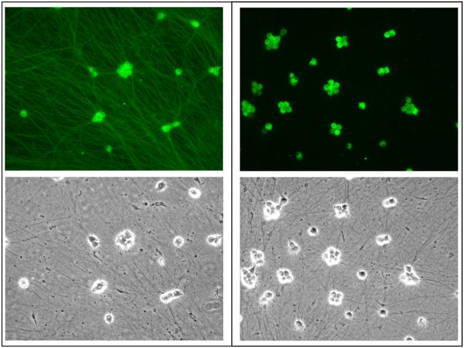 mouse and human neuronal cultures are used to study HSV infection