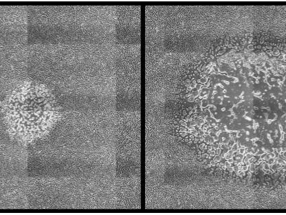 In the lab, HSV is grown on layers of epithelial cells. This tiled microscope image shows two closely related strains of HSV.
