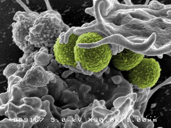Hospital-Associated Methicillin-resistant Staphylococcus aureus (MRSA) Bacteria