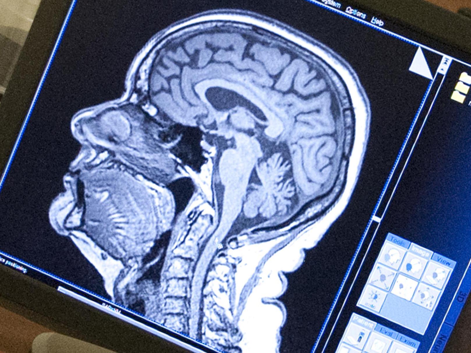 mri scan data on computer