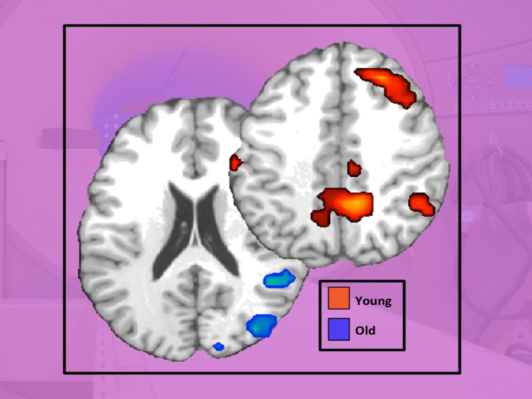 illustration showing scan of young and old brain